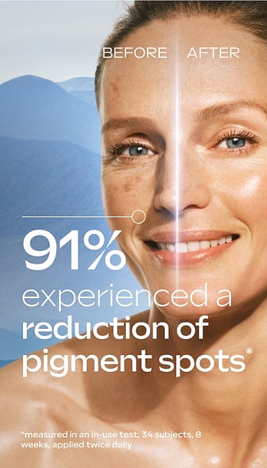 91% experienced a reduction of pigment spots