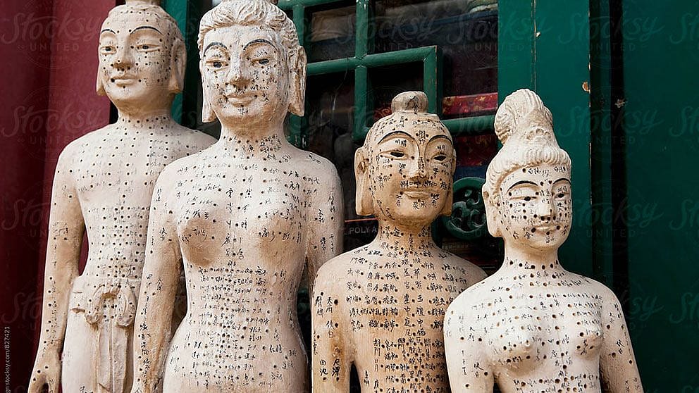 acupuncture