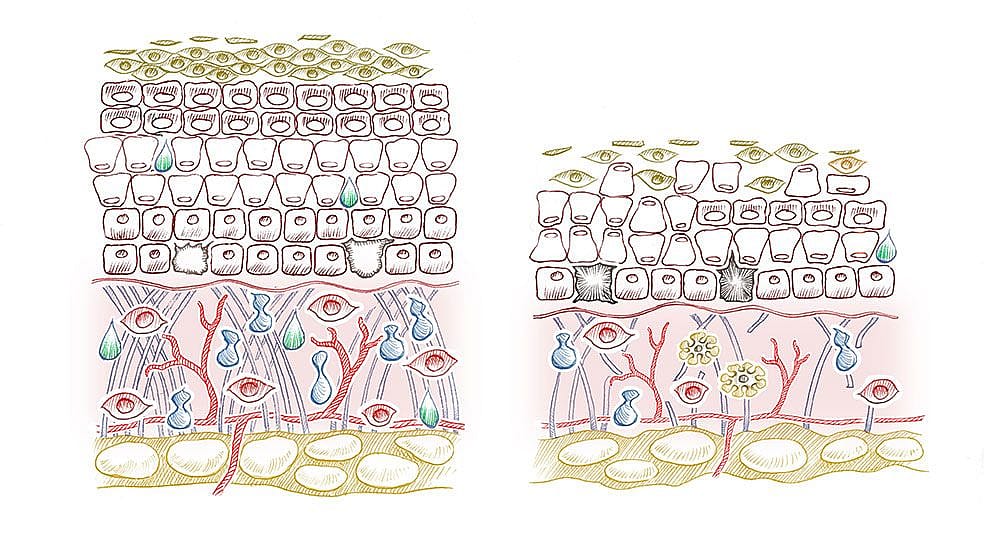 image_illustration-skin.jpg
